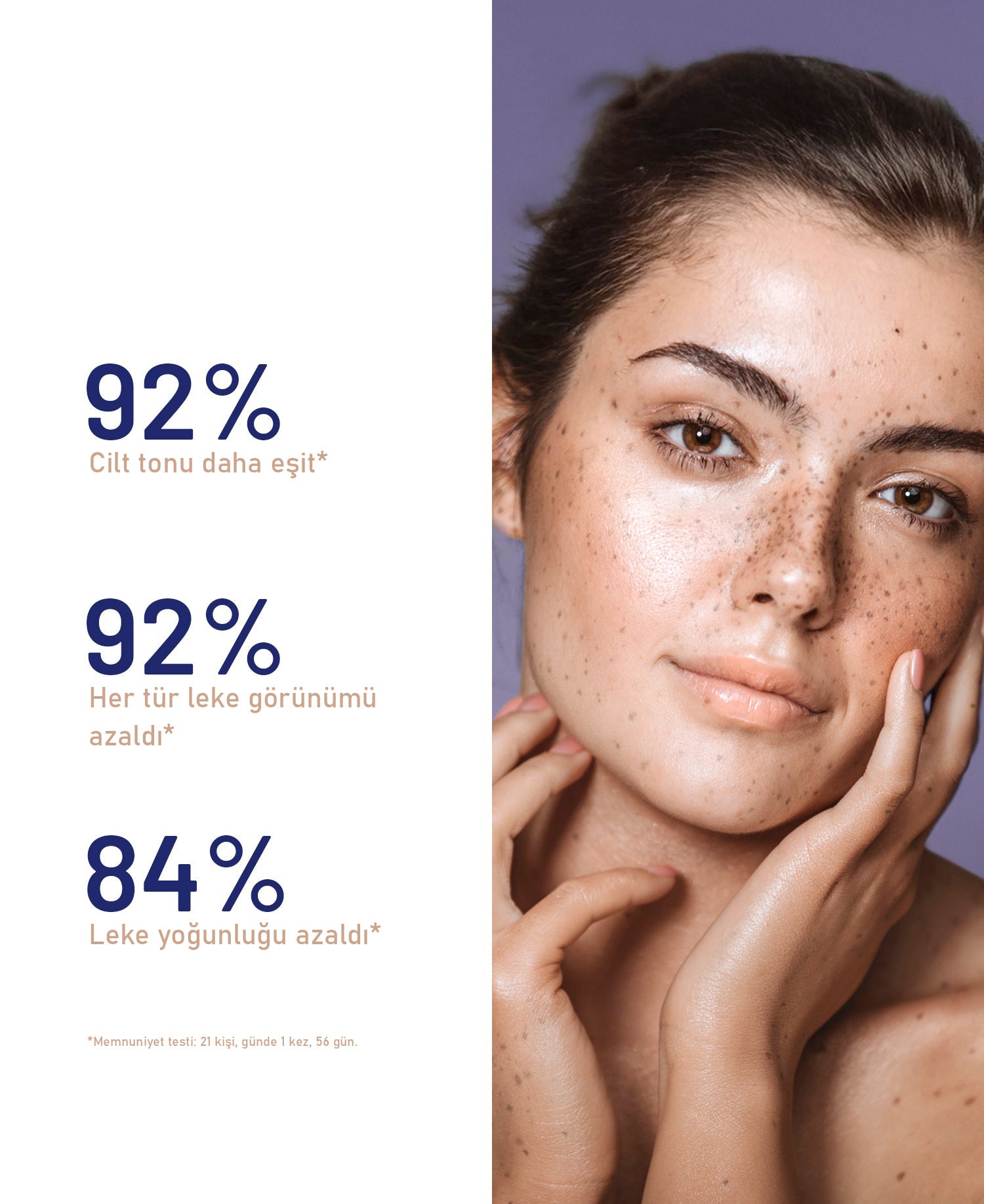 SOSKIN Meladerm Yoğun Leke Karşıtı Serum 30 ml ürün ambalajı